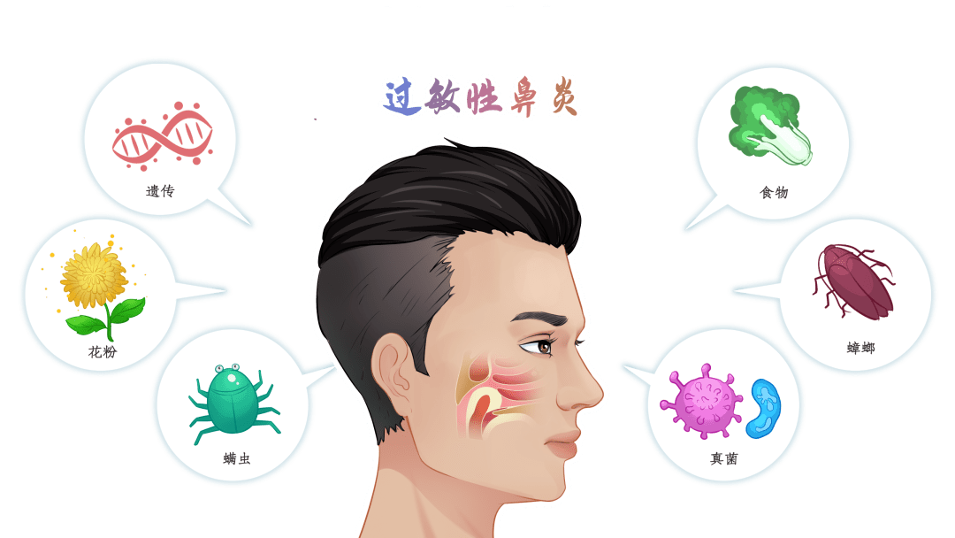 重庆治疗过敏性鼻炎医院